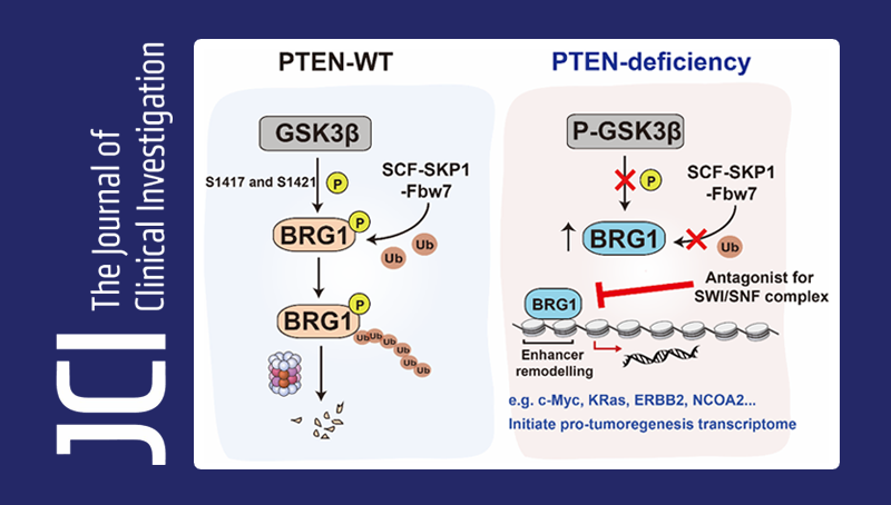 秦骏研究组发现协同致死PTEN缺失前列腺肿瘤的表观遗传基因