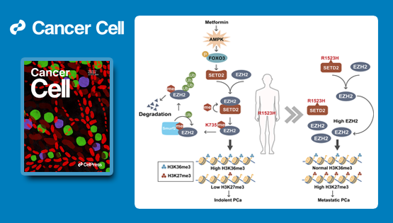 秦骏研究组等合作研究揭示前列腺癌中组蛋白H3K36三甲基转移酶SETD2的重要功能及调控机制
