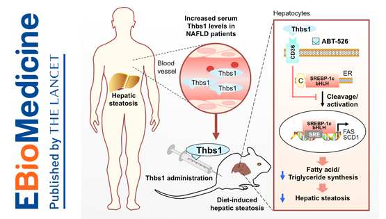 李于研究组合作发现非酒精性脂肪肝的新型生物标志物与治疗靶点
